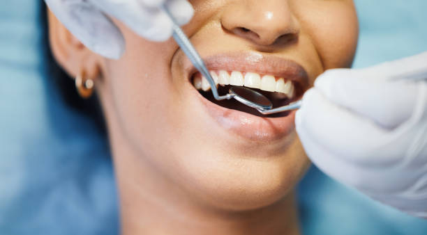 Best Root Canal Treatment  in Griffith, IN